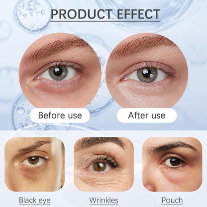 Instant Eye Tightener Primer – Firming Under Eye Serum with Hyaluronic Acid & Vitamin E