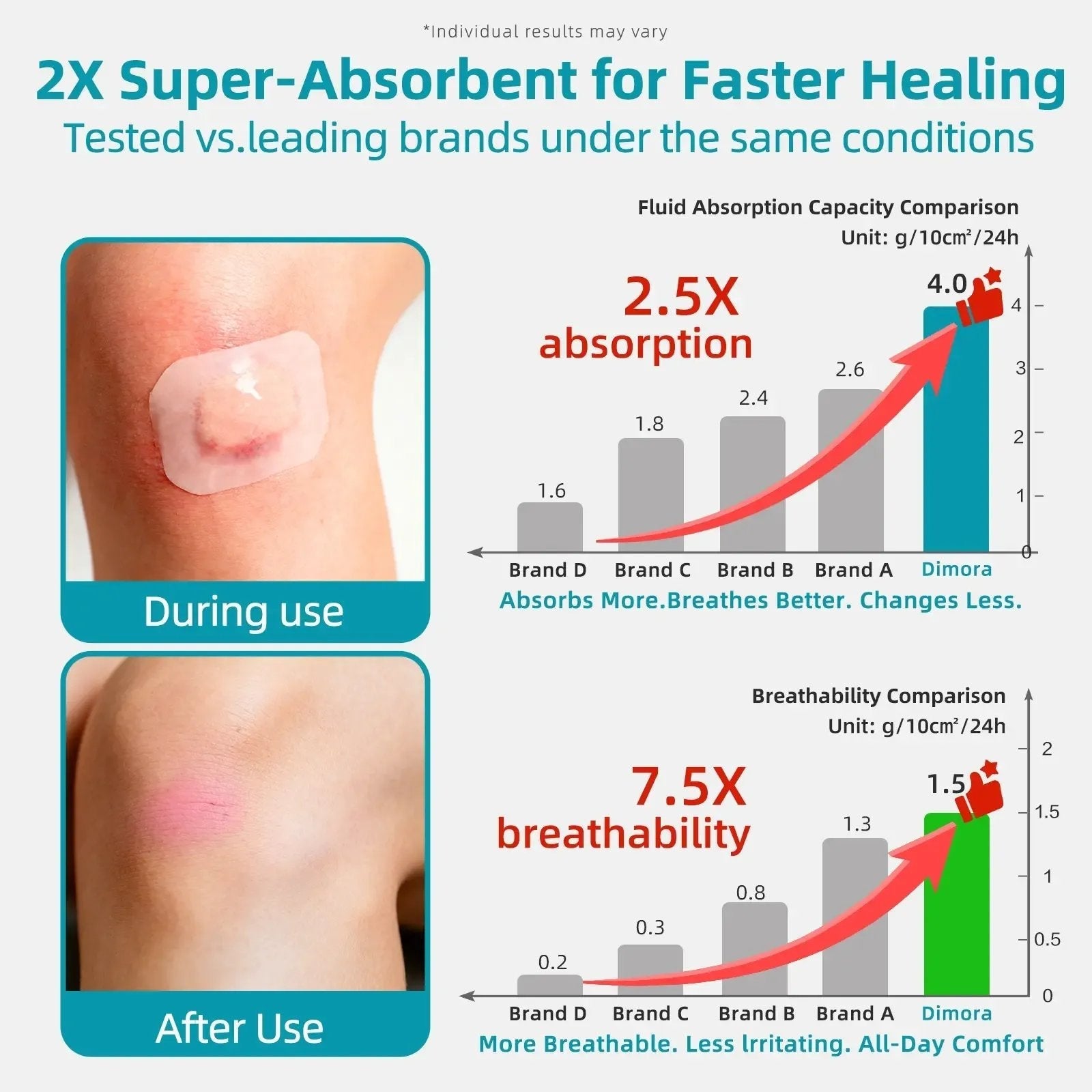 🏆75K+ SOLD!✨ Medical-Grade Hydrocolloid Acne Patch Roll