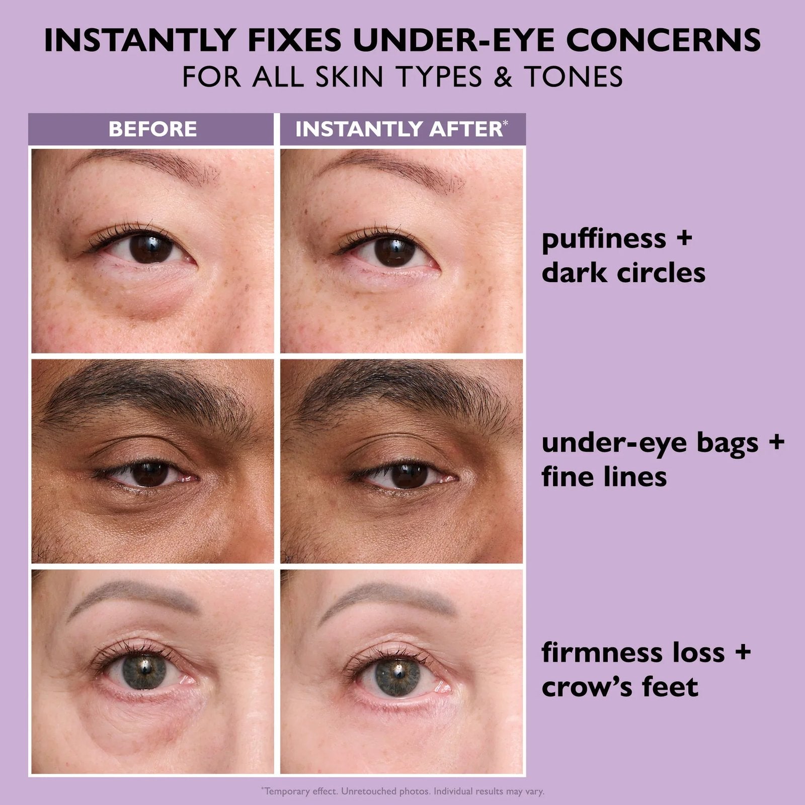 Instant Eye Tightener Primer – Firming Under Eye Serum with Hyaluronic Acid & Vitamin E