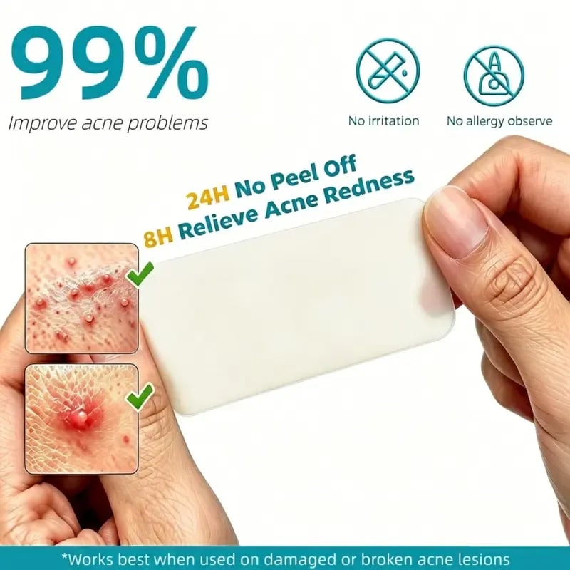 🏆75K+ SOLD!✨ Medical-Grade Hydrocolloid Acne Patch Roll